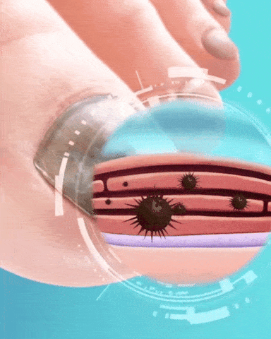 DermiPure™ Nail Rescue — Clear, Confident Nails You'll Love to Show Off Fast