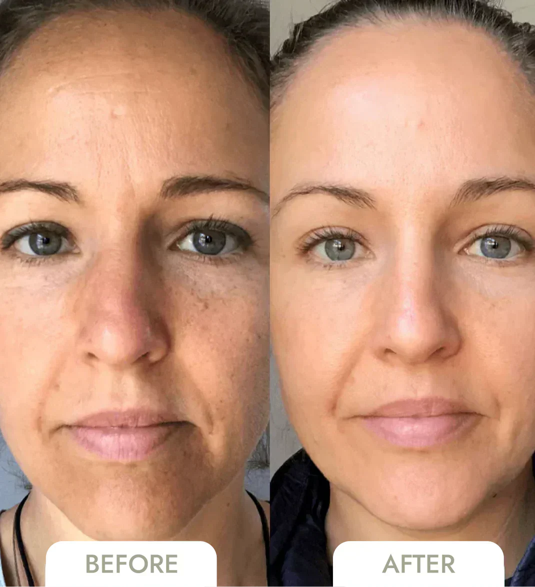 RadianceRise™ — Reveal Youthful, Glowing Skin with Effortless Firmness