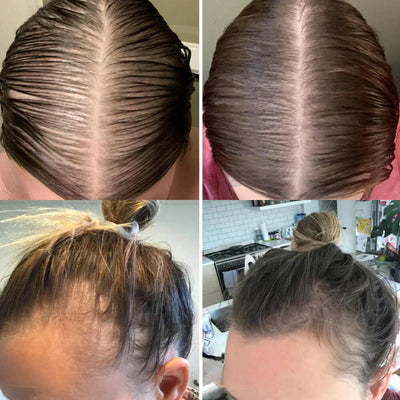 VitaMane™ — Awaken Your Scalp and Unleash a Fuller, Radiant Mane in Just 45 Days