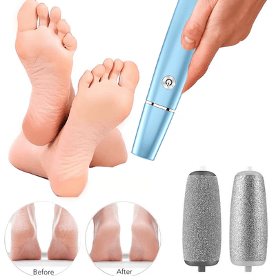 Softride™ — Glide Into Silky, Pain-Free Feet You’ll Proudly Show Off