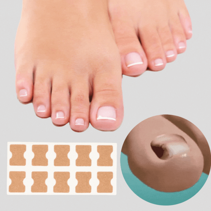 FlexiCure™ — Walk Pain-Free with Nails That Finally Feel and Look Perfect
