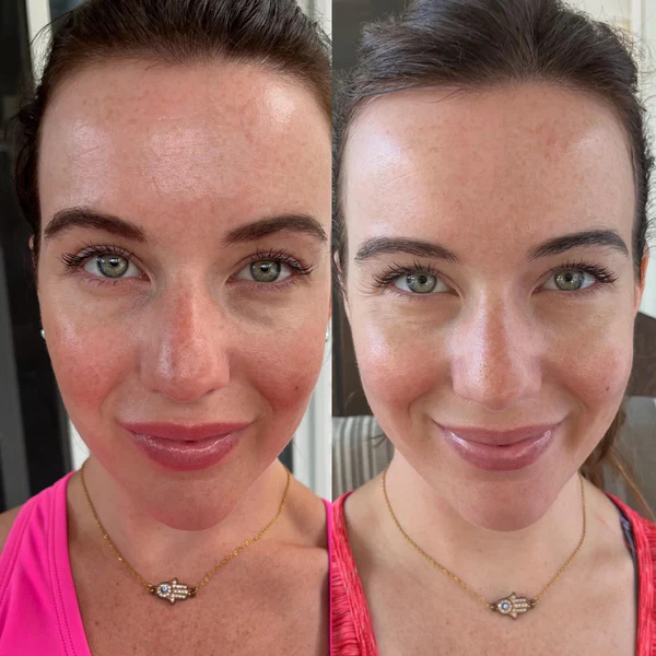 RadiantWave™ Mask — Unlock Your Skin’s Natural Glow with Effortless, Spa-Quality Care