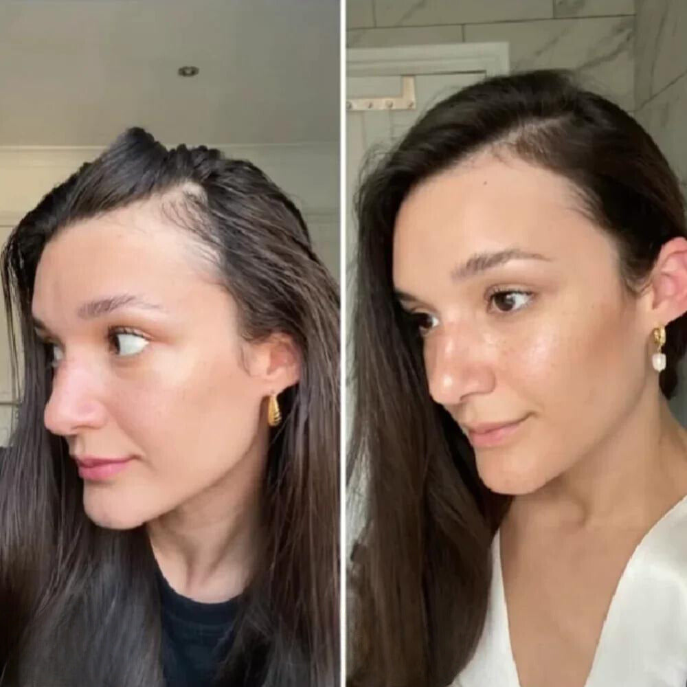 VitaMane™ — Awaken Your Scalp and Unleash a Fuller, Radiant Mane in Just 45 Days