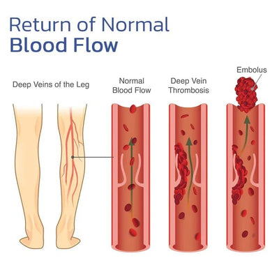 ThermaFlex™ — Feel the Soothing Heat That Frees Your Knees and Fuels Your Freedom