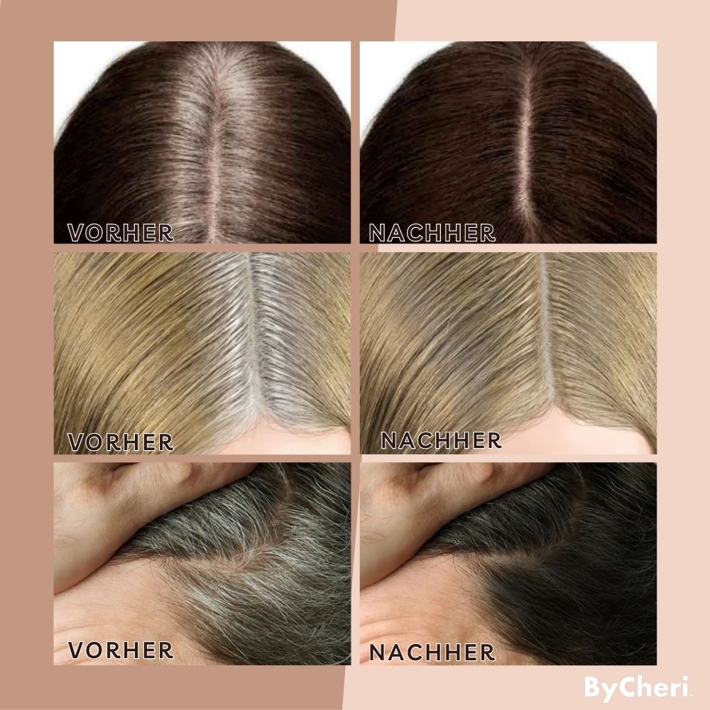 GlowThick™ — Instantly Reclaim a Youthful, Fuller Hairline That Turns Heads