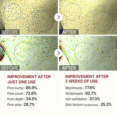 SilkRadiance™ Exfoliant — Glow Fearlessly with Silky, Poreless Skin Every Day