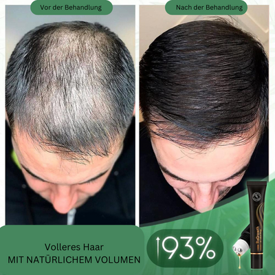 RamiraFortis™ — Ignite Your Scalp to Reveal Fuller, Thicker Hair That Commands Attention