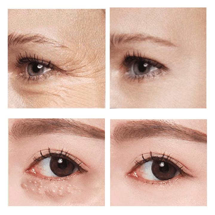 RaminaLift™ — Instantly Brighten and Revitalize Your Eyes for a Youthful, Energized Look