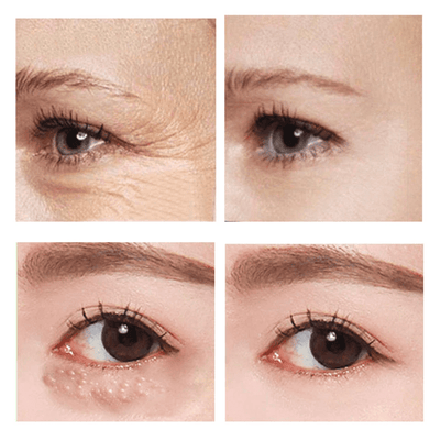 RaminaLift™ — Instantly Brighten and Revitalize Your Eyes for a Youthful, Energized Look
