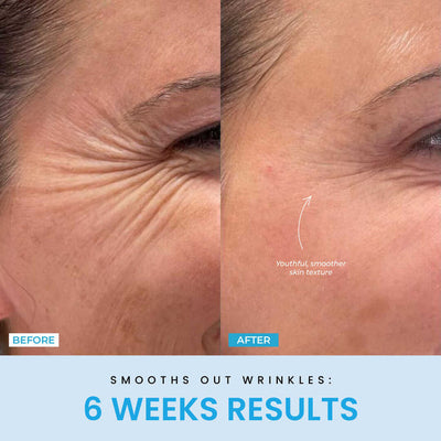 VeroLift™ — Reveal a Sculpted Jawline and Radiant Glow in Minutes Daily