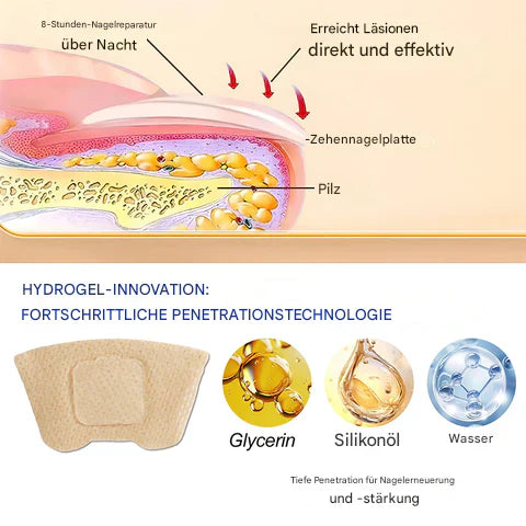 ClearNailX™ — Restore Your Nails’ Natural Beauty Quietly and Confidently All Day Long