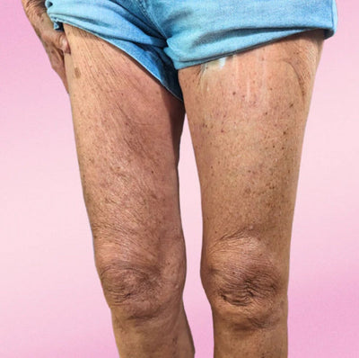 LiftAura™ — Instantly Tighten & Smooth Skin for All-Day Confidence