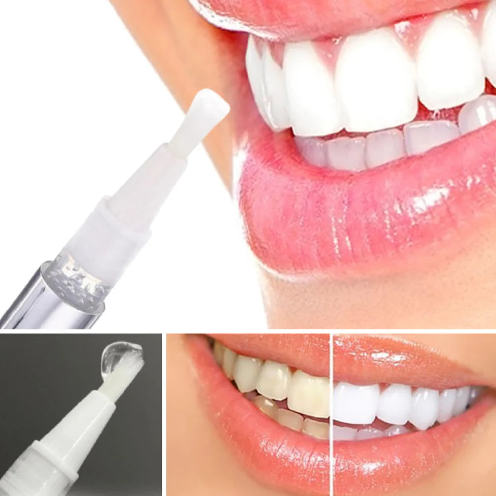LustreBeam™ — Ignite Instant All-Day Confidence with Every Brilliant Smile