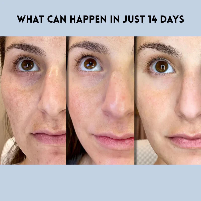 VivaLift™ — Instantly Transform Your Look with a Radiant, Youthful Glow