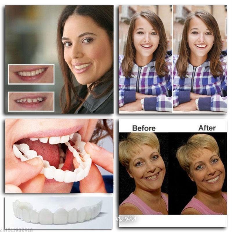 RadiantSmile™ — Own Every Moment with a Flawless, Pain-Free Smile