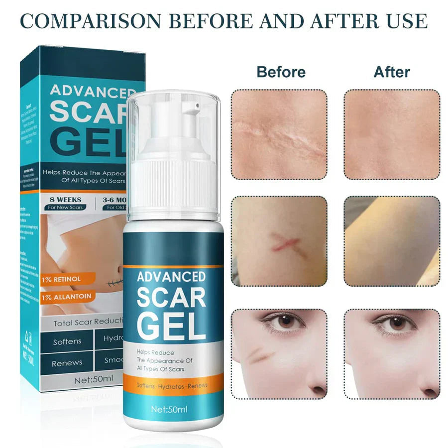 ScarEase™ — Restore Your Skin’s Smooth, Flawless Glow and Confidence