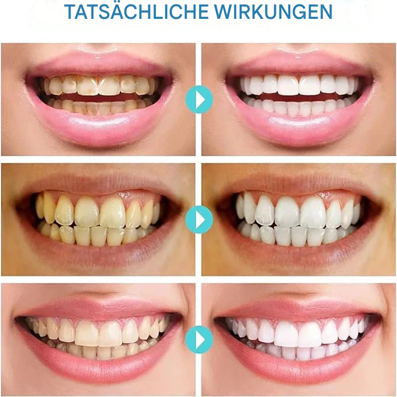 SmileVibe™ — Unlock a Stunning, Head-Turning Smile That Radiates Confidence