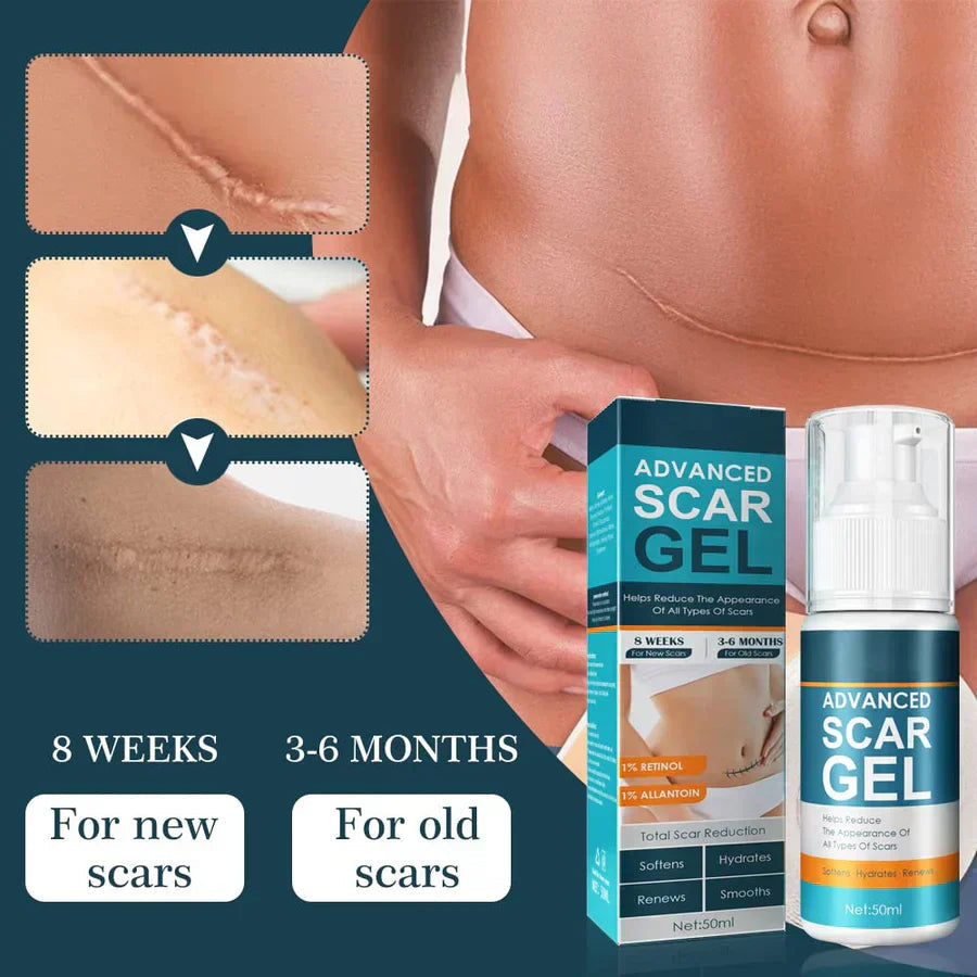 ScarEase™ — Restore Your Skin’s Smooth, Flawless Glow and Confidence