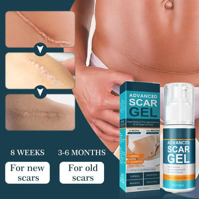 ScarEase™ — Restore Your Skin’s Smooth, Flawless Glow and Confidence