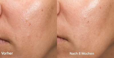 LumaPure™ — Unleash Your Glow with Calming, Spot-Fading Softness