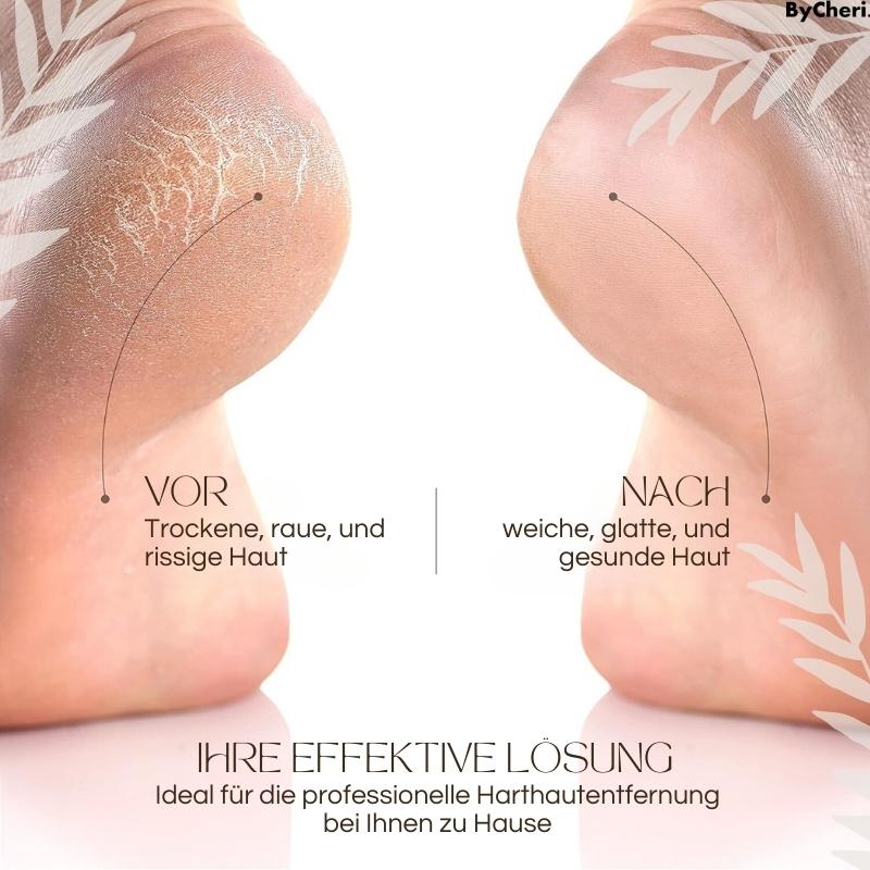 PediLuxe™ — Effortlessly Enjoy Soft, Smooth Feet That Boost Your Confidence